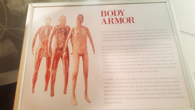 Ballys Body Exhibit e)