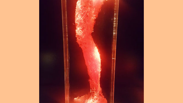 Bally's Body Exhibit: d)