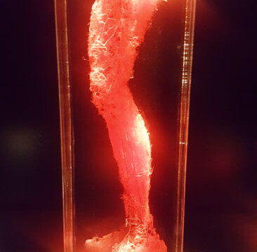 Bally's Body Exhibit: d)