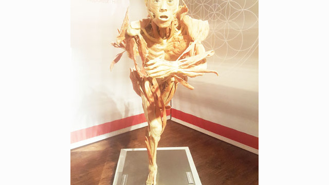 Bally's Body Exhibit b)