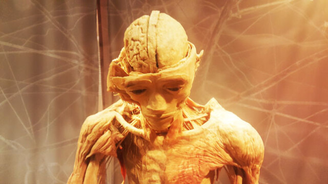 Bally's Body Exhibit a)